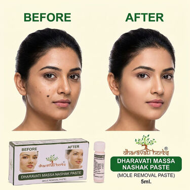 Ayurvedic Massa Removal Cream