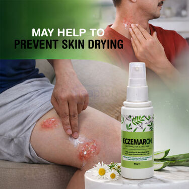 Fungal Care Cream For Eczema (BCER)
